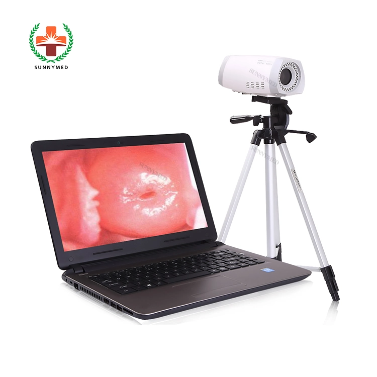 Sy-F003 Guangzhou Delivery Electronic Colposcope for Gynecologic Examination