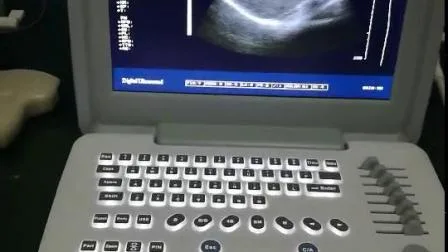 Krankenhaus S/W Digitaler tragbarer Ultraschallscanner für Gynäkologie
