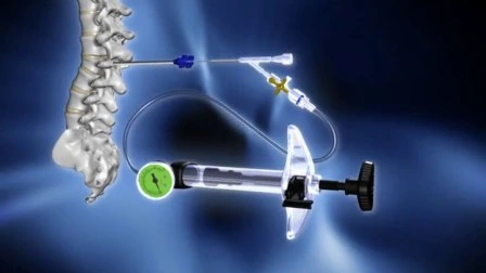 Dragon Crown Medical Orthopädische Instrumente für die minimalinvasive Chirurgie der Wirbelsäule